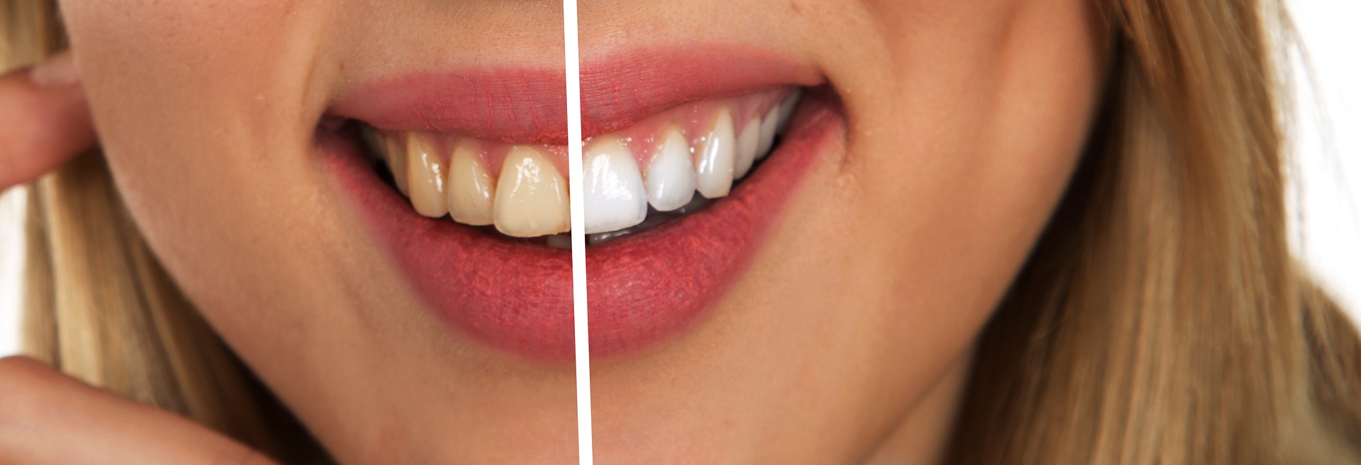 The Relevance of a Cosmetic Dentist